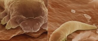 Кожный клещ Demodex — возбудитель демодекоза