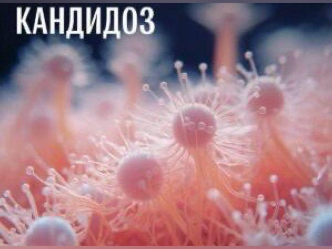 Грибы рода Candida под микроскопом — овальные клетки дрожжеподобных грибов